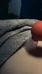 Cupping